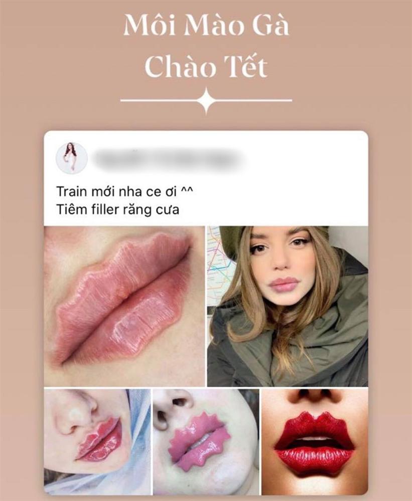 Ai bắt trend quái dị nhanh như Hari Won: hết tóc rong biển giờ đến môi mào gà, môi sò đón Tết-1