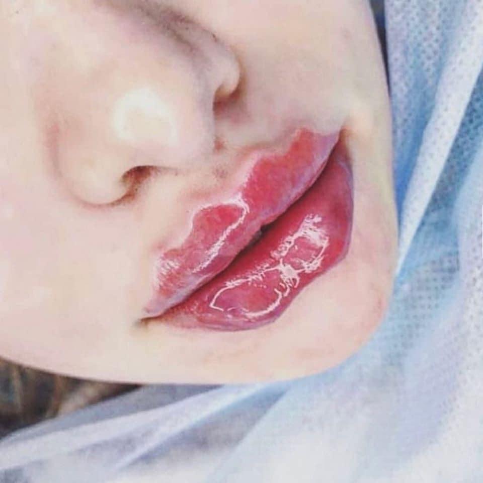 Ai bắt trend quái dị nhanh như Hari Won: hết tóc rong biển giờ đến môi mào gà, môi sò đón Tết-2