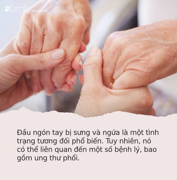 Những dấu hiệu nhìn là thấy của bệnh ung thư ác tính trên bàn tay và bàn chân mà rất nhiều người bỏ qua-1