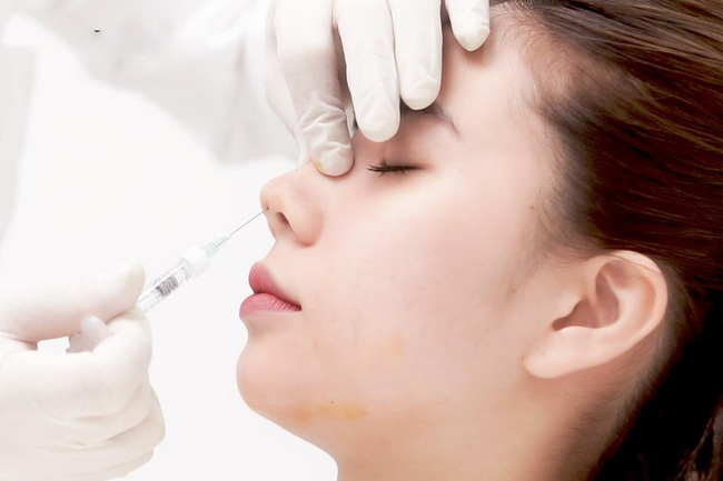Rùng rợn những hình ảnh nâng chân mày, nâng mũi sởn gai ốc, người phụ nữ sau phẫu thuật đưa ra lời khuyên chân thành đến chị em ham làm đẹp-6