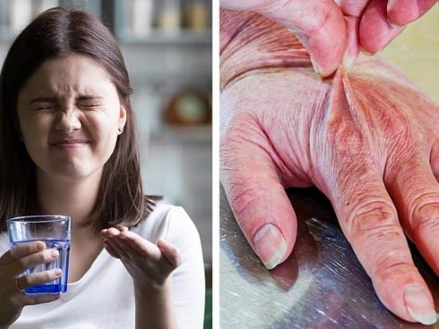2 quả thận chi chít sỏi vì nhiều người không biết 5 dấu hiệu này
