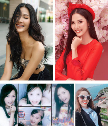 Loạt sao chứng minh sức mạnh vi diệu của niềng răng và thời điểm vàng để bạn cứu vãn” nhan sắc nhờ chỉnh nha-2