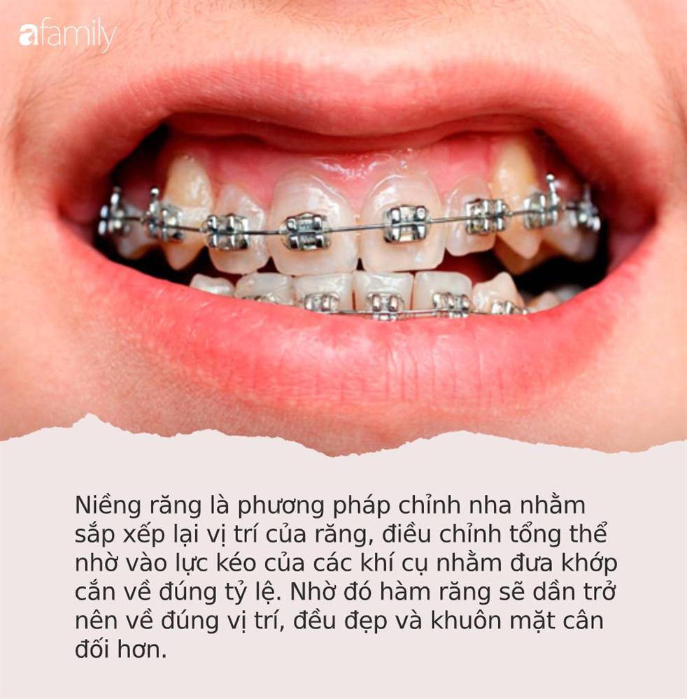 Loạt sao chứng minh sức mạnh vi diệu của niềng răng và thời điểm vàng để bạn cứu vãn” nhan sắc nhờ chỉnh nha-4