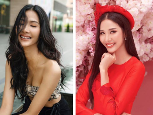 Loạt sao chứng minh sức mạnh vi diệu của niềng răng và thời điểm vàng để bạn “cứu vãn” nhan sắc nhờ chỉnh nha