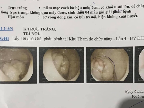 Chỉ một triệu chứng này, đi khám ra ung thư giai đoạn cuối-1