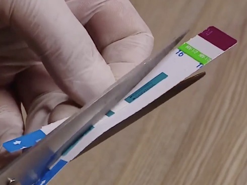 Phanh phui vụ cắt đôi que thử HIV, viêm gan B ở BV Xanh Pôn: Chưa từng thấy việc này”-4