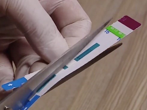Giám đốc BV Xanh Pôn phủ nhận việc trộn máu và ăn bớt vật tư xét nghiệm