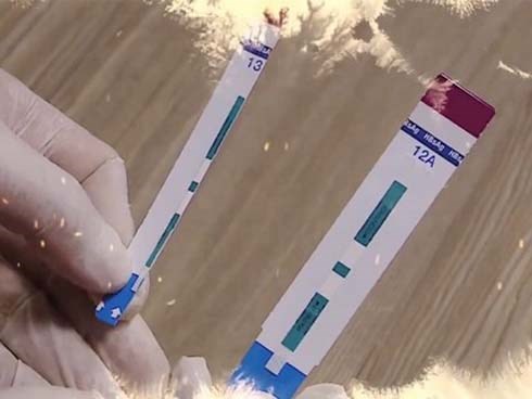 Cắt đôi que xét nghiệm HIV, bớt xén vật tư nguy hiểm thế nào?