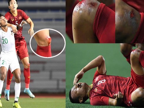 Mang hành vi phe vé đắt cắt cổ sang tận Philippines, một số người Việt khiến chính đồng bào của mình giận tím mặt trước thềm chung kết SEA Games 30-10