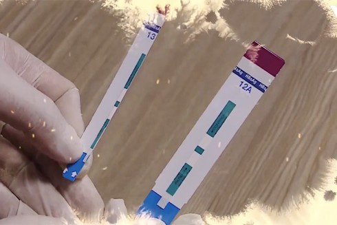 Bệnh viện Xanh Pôn lên tiếng vụ cắt đôi que thử nhanh HIV: Khoa Vi sinh Y học không xin phép, báo cáo lãnh đạo, tự ý thử nghiệm trên mẫu máu bệnh nhân-1