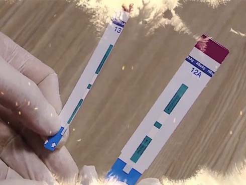 Vụ cắt que thử viêm gan B, HIV tại BV Xanh Pôn: Cắt chia đôi hoàn toàn thì giá trị kết quả như nhau?-3