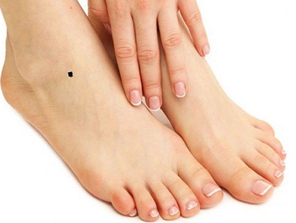 Dấu hiệu ở chân cảnh báo bệnh cực kỳ nguy hiểm, khám ngay kẻo muộn-3