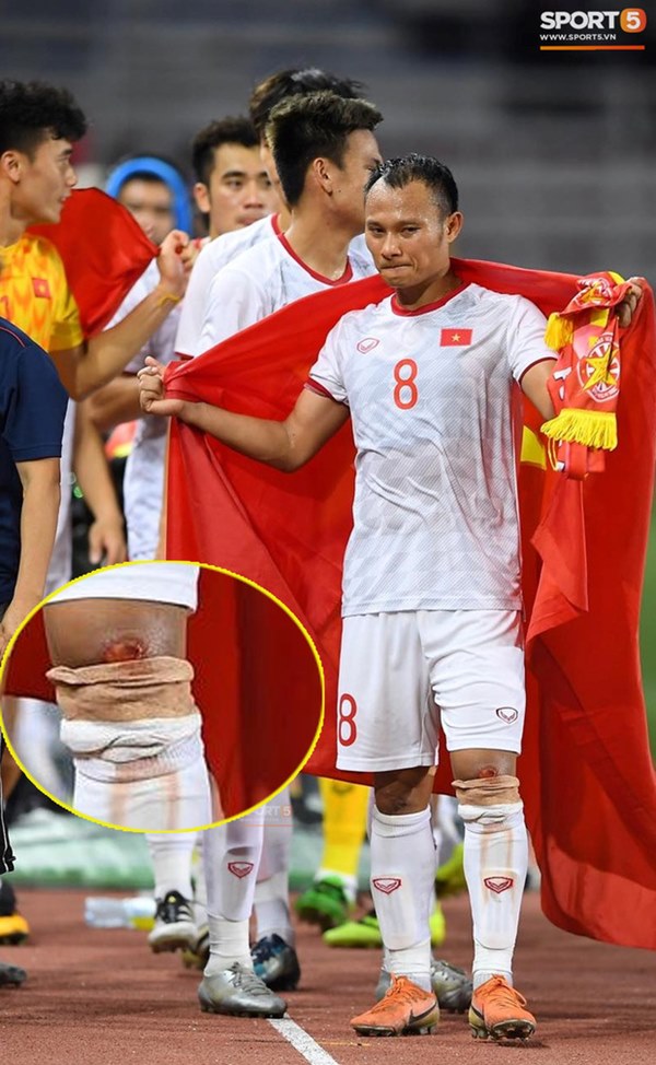 Góc chạnh lòng: Trọng Hoàng đứng một mình buồn thiu với đầu gối chảy máu khi cả đội đang ăn mừng vô địch SEA Games-1