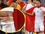 Hậu vệ phải số 1 tuyển Việt Nam chấn thương nặng hơn dự kiến, lỡ ngày V.League trở lại-3