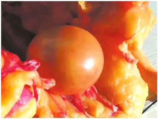 Mổ con vịt đực nuôi 5 năm, ẵm bảo bối trong bụng ngang cả gia tài-1