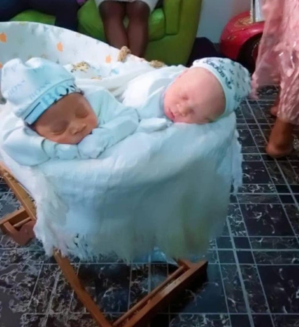 Cặp sinh đôi chào đời cách nhau vài phút nhưng khiến bác sĩ cũng sốc, cả bệnh viện kéo đến chụp ảnh-2