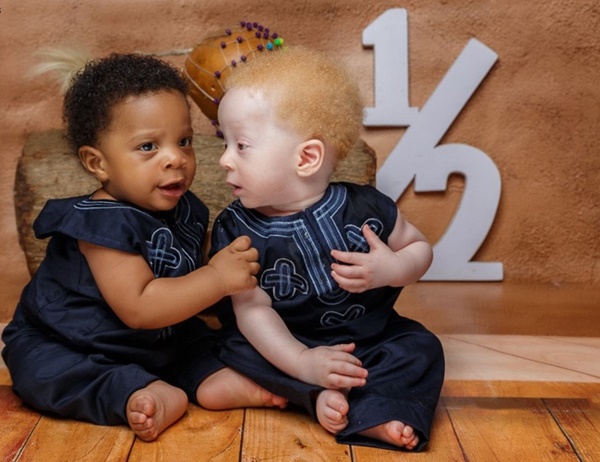 Cặp sinh đôi chào đời cách nhau vài phút nhưng khiến bác sĩ cũng sốc, cả bệnh viện kéo đến chụp ảnh-4