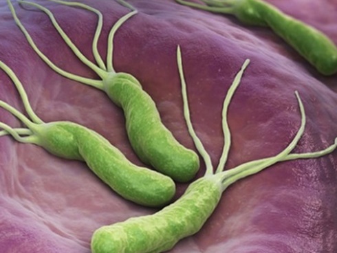 Không ngờ loại gia vị người Việt nào cũng từng dùng lại gây ung thư dạ dày-2