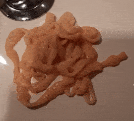 Kinh hãi những ca lấy được sán dài cả mét từ trong cơ thể, làm thế nào để phòng tránh sán dây làm tổ?-4