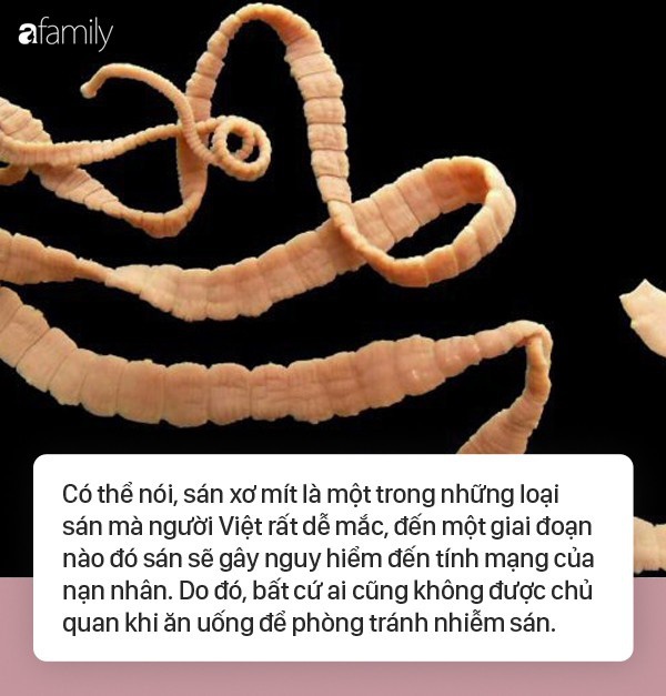 Kinh hãi những ca lấy được sán dài cả mét từ trong cơ thể, làm thế nào để phòng tránh sán dây làm tổ?-6