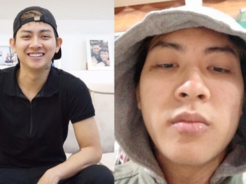 Hoài Lâm lại xuất hiện với vẻ ngoài phờ phạc, tiều tuỵ đến khó nhận ra: Vẻ điển trai phong độ nay còn đâu!