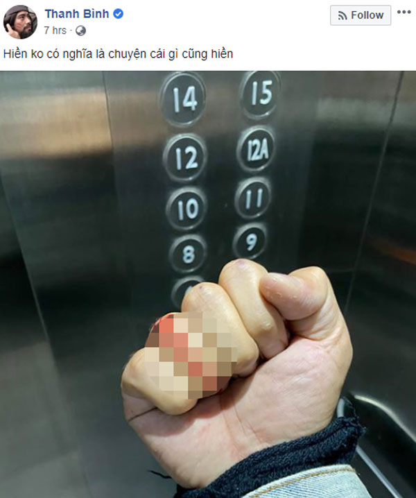 Ngọc Lan bị bắt gặp ôm trai lạ, Thanh Bình bất ngờ chia sẻ chuyện đương đầu với côn đồ-1