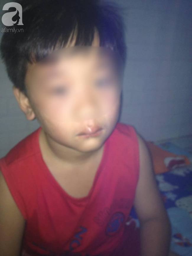 Vụ cha ép con 8 tuổi uống rượu gây phẫn nộ: Người vợ xin dư luận tha thứ cho chồng-2