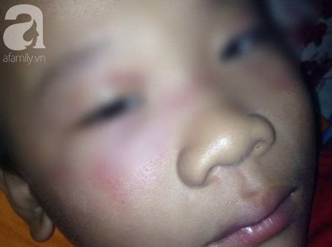 Vụ cha ép con 8 tuổi uống rượu gây phẫn nộ: Người vợ xin dư luận tha thứ cho chồng-3