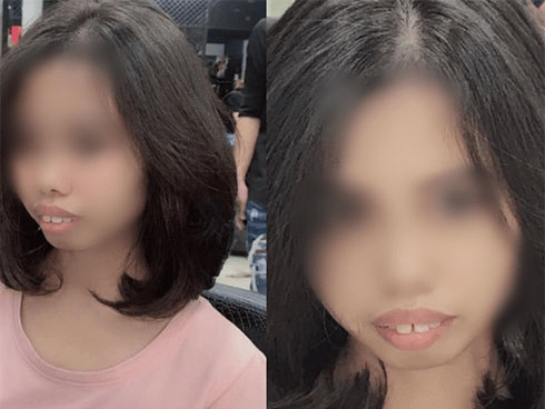 Làm tóc xinh đón Tết, cô gái hết hồn khi tẩy tóc bị rụng nguyên cả mảng đến mức hói đầu-7