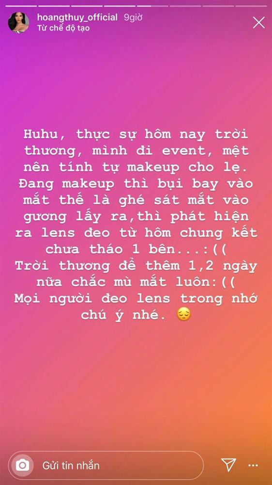 Hoàng Thuỳ chia sẻ việc suýt nữa thì mù vì bỏ quên lens trong mắt 4 ngày-2