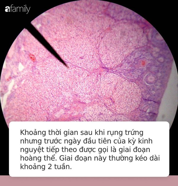 Đây là kiểu quan hệ tình dục tai hại khiến phụ nữ phải nhập viện cấp cứu vì vỡ tử cung-2