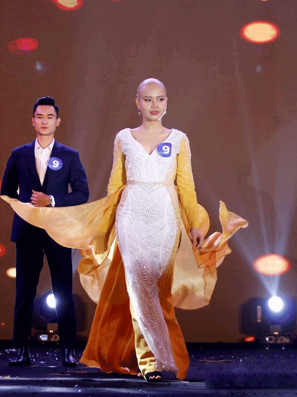 Nữ sinh ung thư giành giải Miss truyền cảm hứng: Ung thư không phải ‘án tử hình’-3