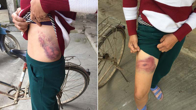 Cô ruột tố bị cháu trai hành hung dẫn đến sang chấn, suy sụp trong ngày xây mộ cho bố-3