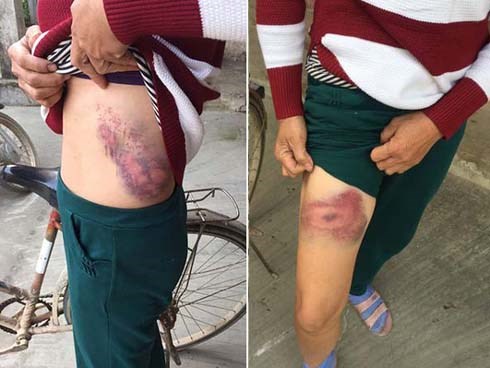 Cô ruột tố bị cháu trai hành hung dẫn đến sang chấn, suy sụp trong ngày xây mộ cho bố