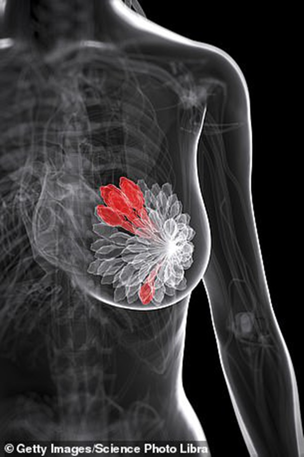 Chỉ mất một tuần, bạn sẽ đánh bại được ung thư vú lại không chịu đau đớn lâu dài nhờ giải pháp siêu hay này!-2