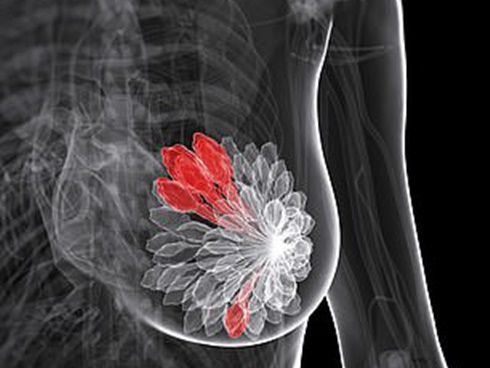 3 loại thực phẩm được cảnh báo là chất gây ung thư, ăn càng ít càng tốt-5