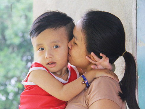 Cô gái 23 tuổi bị viêm gan cấp do dùng thực phẩm chức năng để giảm cân, làm đẹp da: BS chỉ ra lý do thực phẩm chức năng nguy hiểm hơn cả thuốc-5