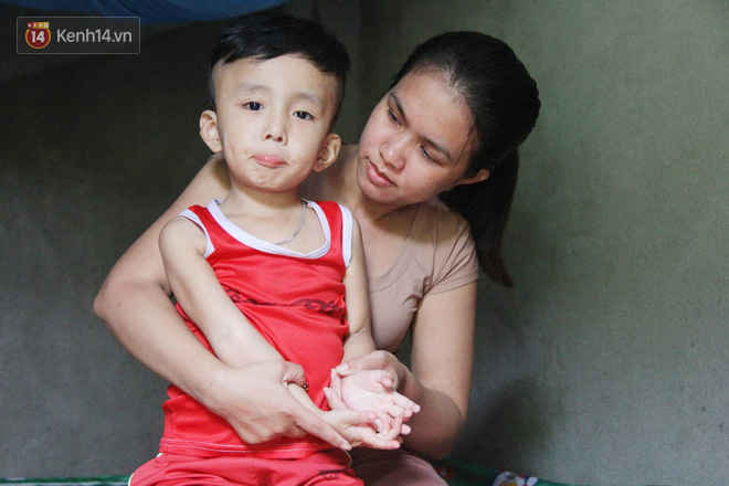 Đường cùng của người mẹ tìm cách bán thận cứu con trai 4 tuổi u não, nào ngờ phát hiện bản thân bị viêm gan C giai đoạn cuối-3