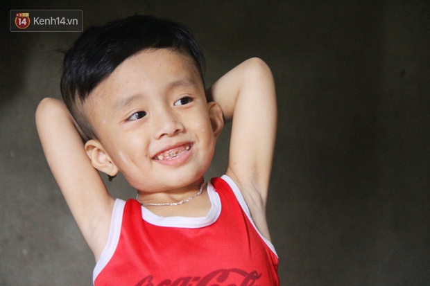 Đường cùng của người mẹ tìm cách bán thận cứu con trai 4 tuổi u não, nào ngờ phát hiện bản thân bị viêm gan C giai đoạn cuối-7