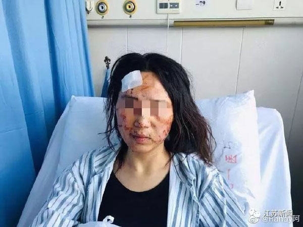 Nghi ngờ vợ dan díu với đồng nghiệp, chồng và bố chồng bạo hành đối phương ngay giữa đường, ép nạn nhân ăn cả chất thải-1