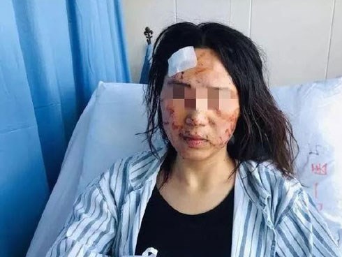 Nghi ngờ vợ dan díu với đồng nghiệp, chồng và bố chồng bạo hành đối phương ngay giữa đường, ép nạn nhân ăn cả chất thải