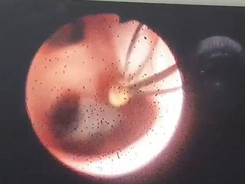 Bệnh viện TP.HCM ghi nhận nhiều ca nguy kịch do thói quen ăn uống-3