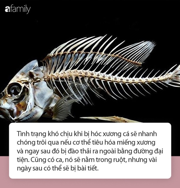 Hóc xương cá đừng có dại mà dùng thứ này chữa kẻo thiệt thân, hãy dắt túi ngay từng bước sơ cứu dưới đây!-2