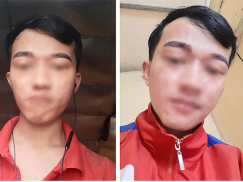 THẢM HỌA LÀM ĐẸP: Ham rẻ, bà thím có đến 3 hàng lông mày-8