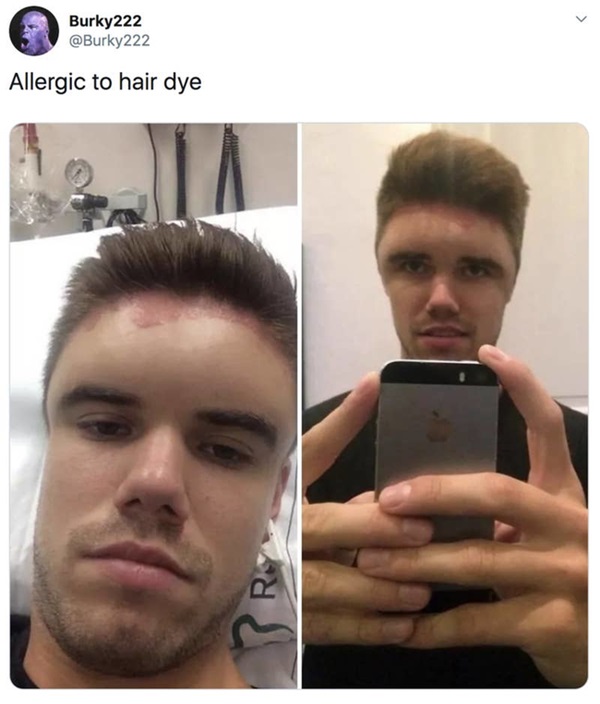 Cho rằng mình đen đủi nhất năm 2019? Hãy yên tâm vì bạn vẫn may mắn chán so với 11 trường hợp dưới đây-11