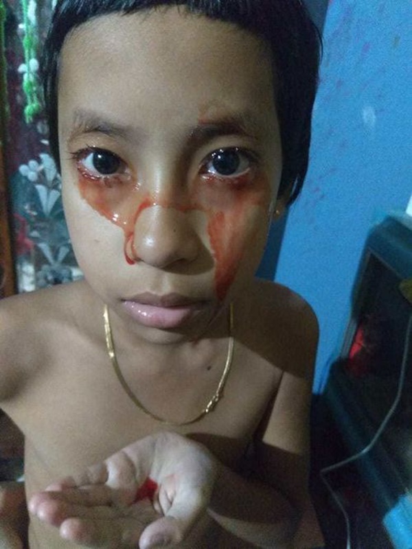 Bé gái 8 tuổi ‘khóc ra máu-1