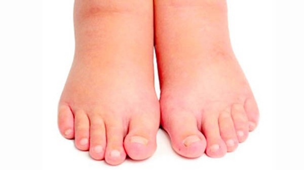 3 dấu hiệu cho thấy thận đã làm việc quá sức, cần được chăm sóc đặc biệt-1