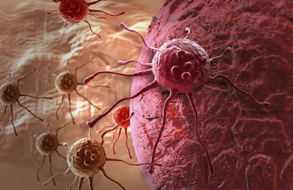 Đáp ứng được 6 điều, chứng tỏ bạn có một cơ thể miễn dịch với ung thư-1