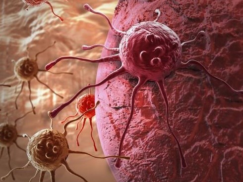 Đáp ứng được 6 điều, chứng tỏ bạn có một 'cơ thể miễn dịch với ung thư'