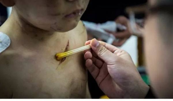 Bé trai bị mẹ bạo hành: Con chỉ còn mỗi mẹ thôi-1